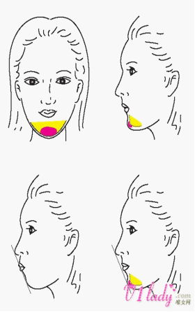 什么样的人适合隆下巴，隆下巴又该注意哪些方